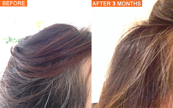 MaxRoot Hair Growth, no dandruff